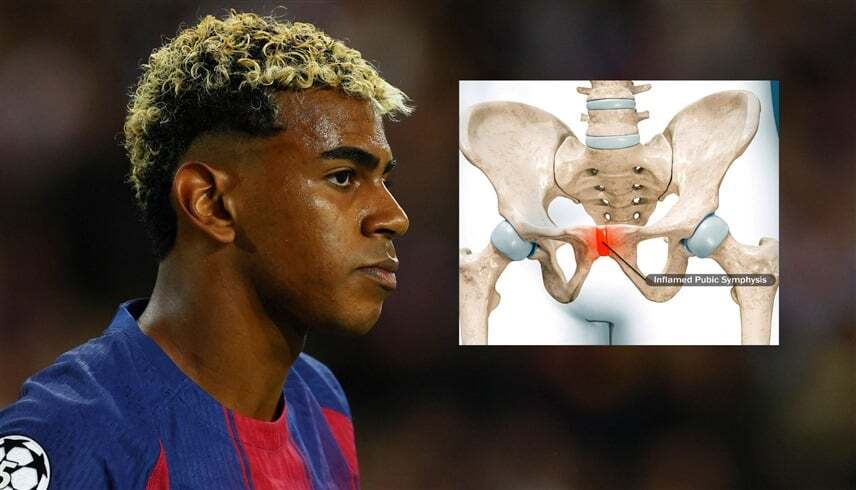 Lamine Yamal  injury details revealed 